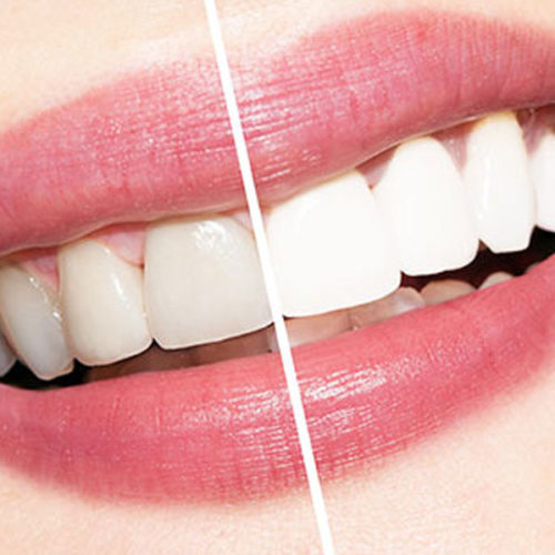 service home banner3