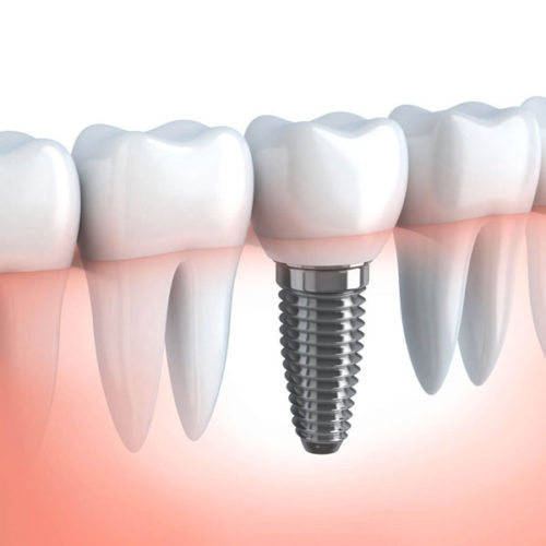 service home banner6